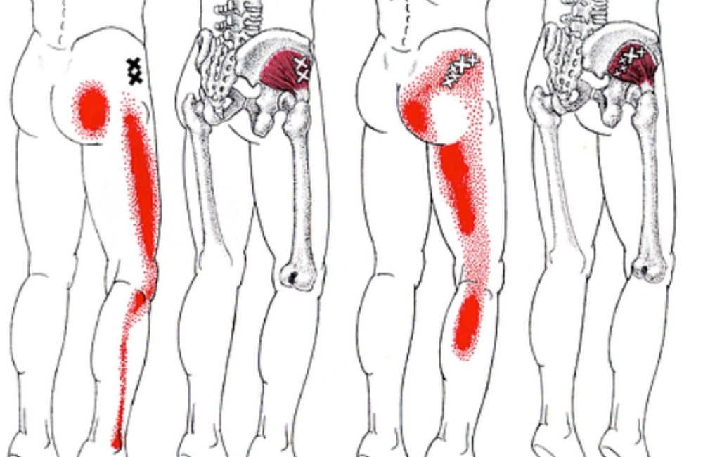 10 deep piriformis stretches to get rid of sciatica hip pain