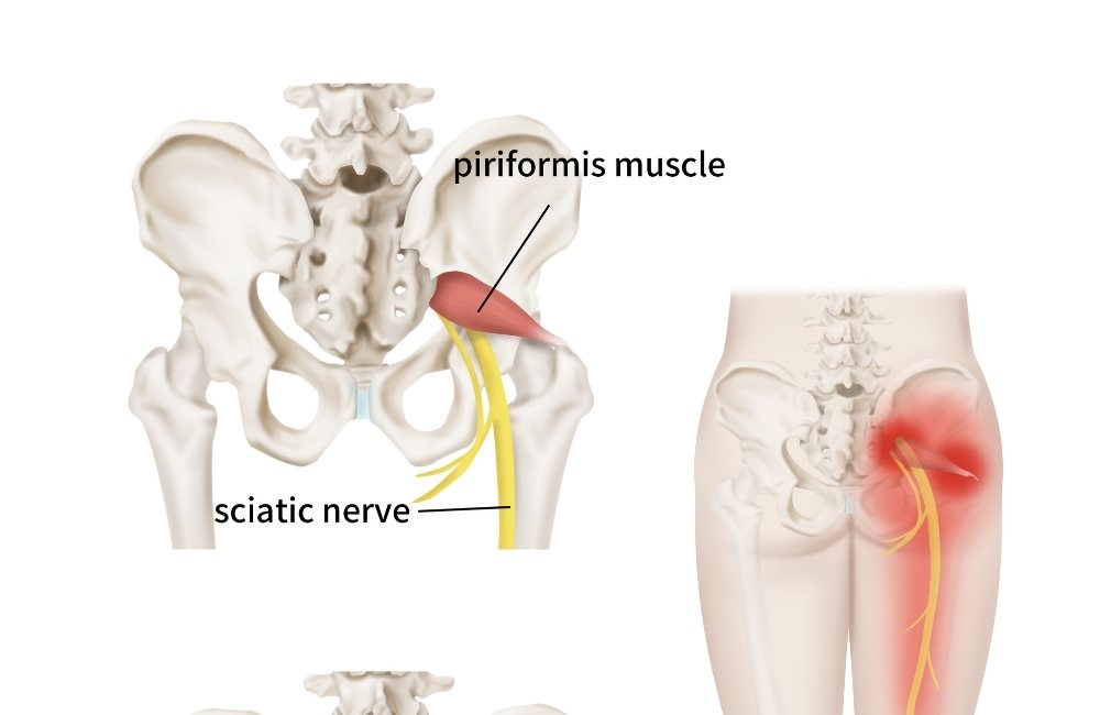 The Piriformis Muscle