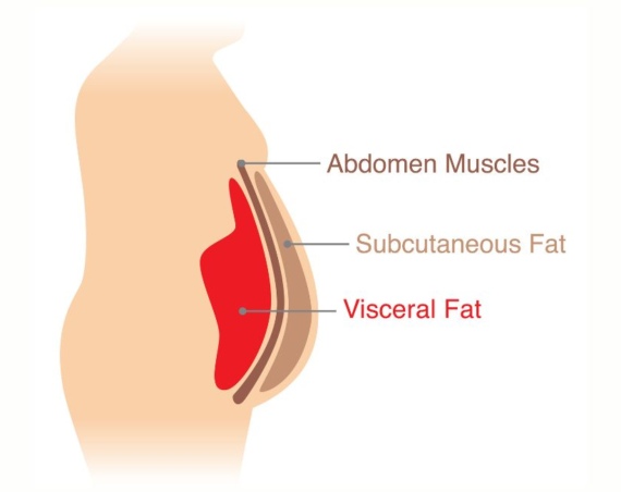 How To Lose Visceral Fat Fast — 3 Simple Steps