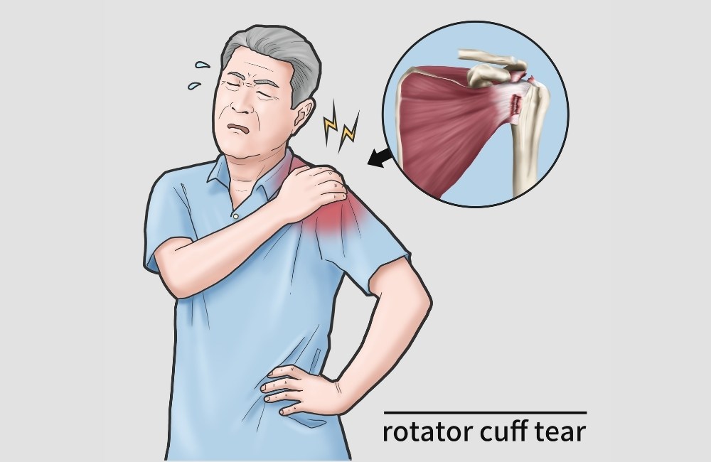 Shoulder Muscles and Joints