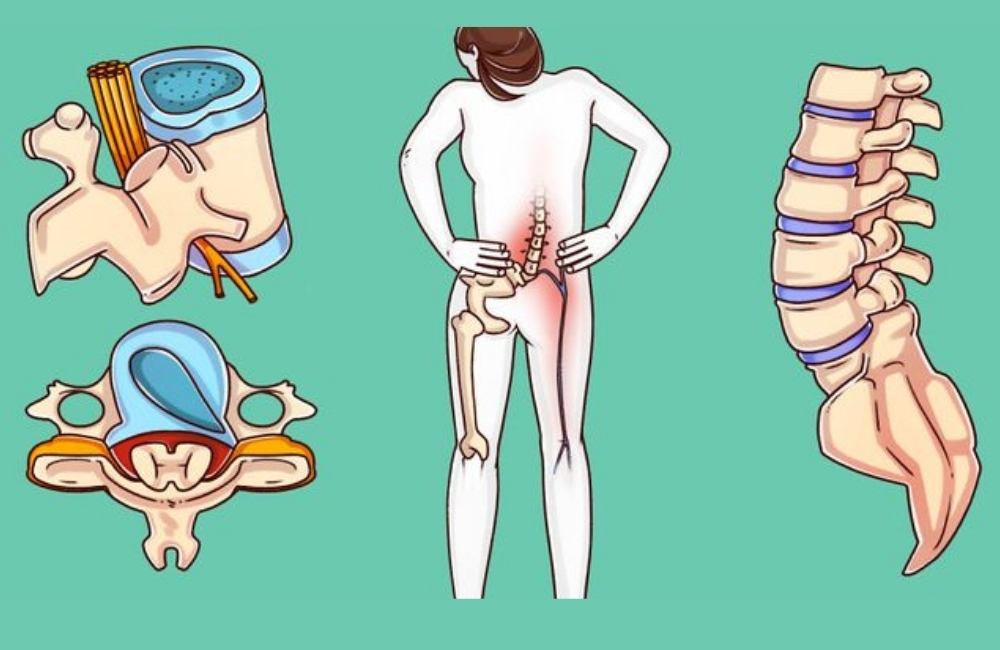 Amosov reveals 6 exercises that can heal your BACK