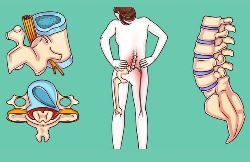 Amosov reveals 6 exercises that can heal your spine