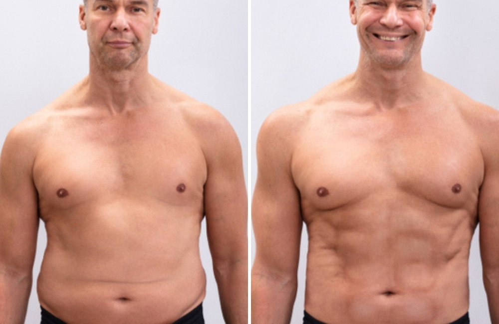 How to Lose Belly Fat For Men - A Three-Pronged Approach for Weight Loss