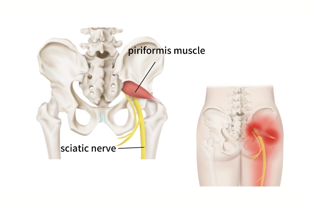 The best piriformis muscle stretch