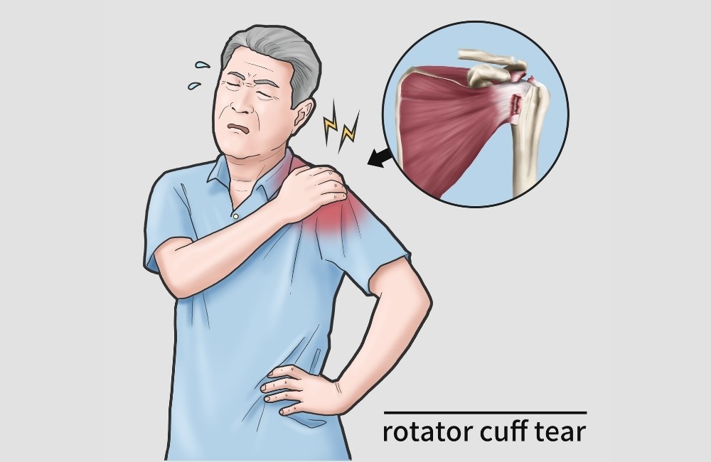 Rotator cuff exercises