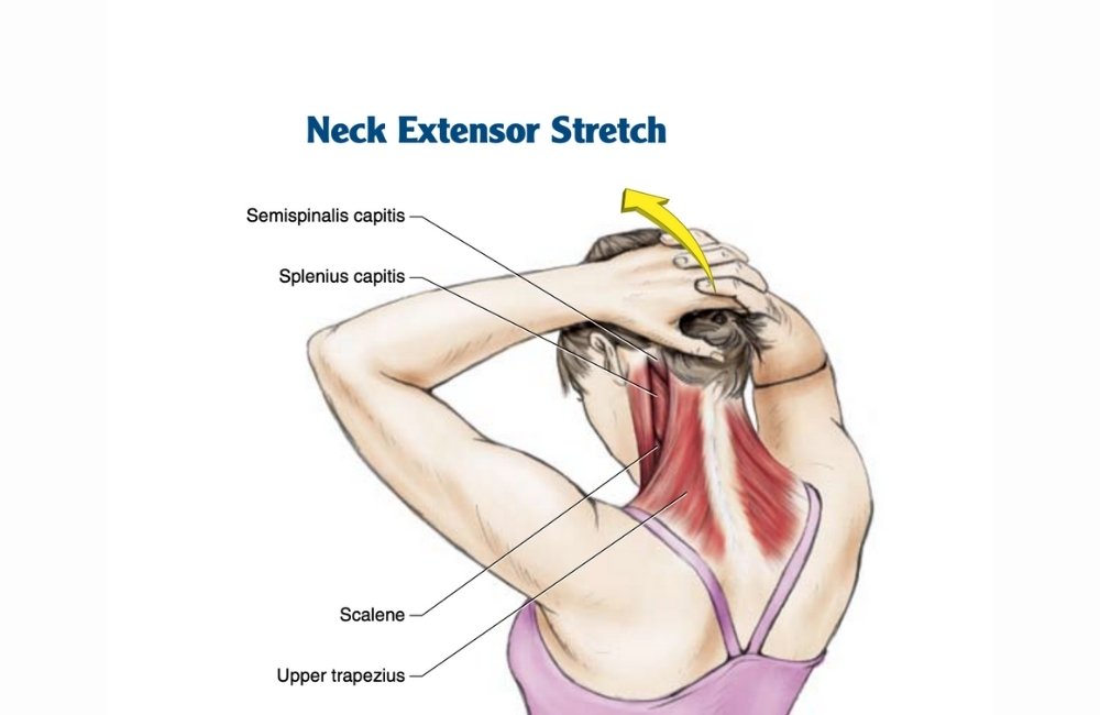 Trapezius/Neck Extensor Stretch