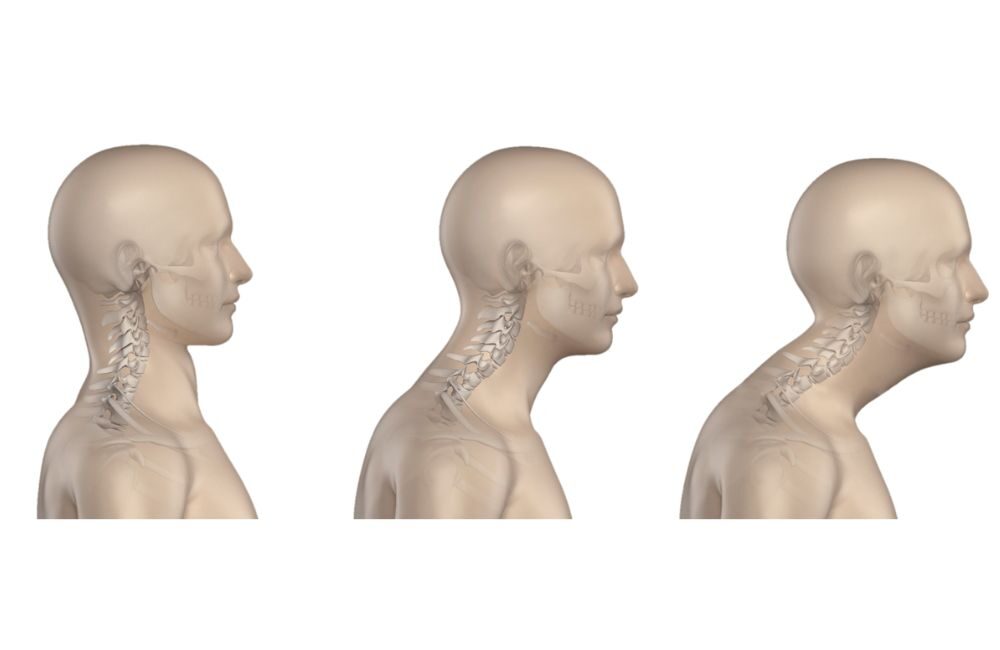 Neck posture online workout