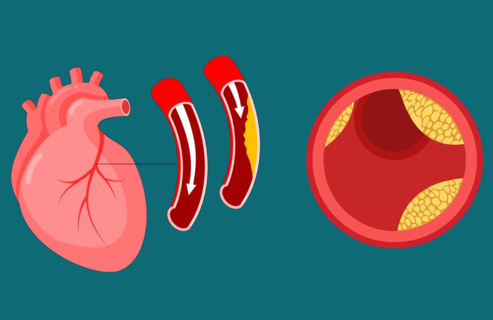 Foods to lower cholesterol naturally