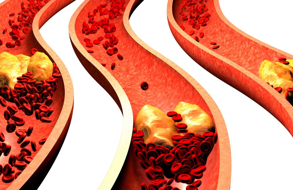 Why Cholesterol Matters