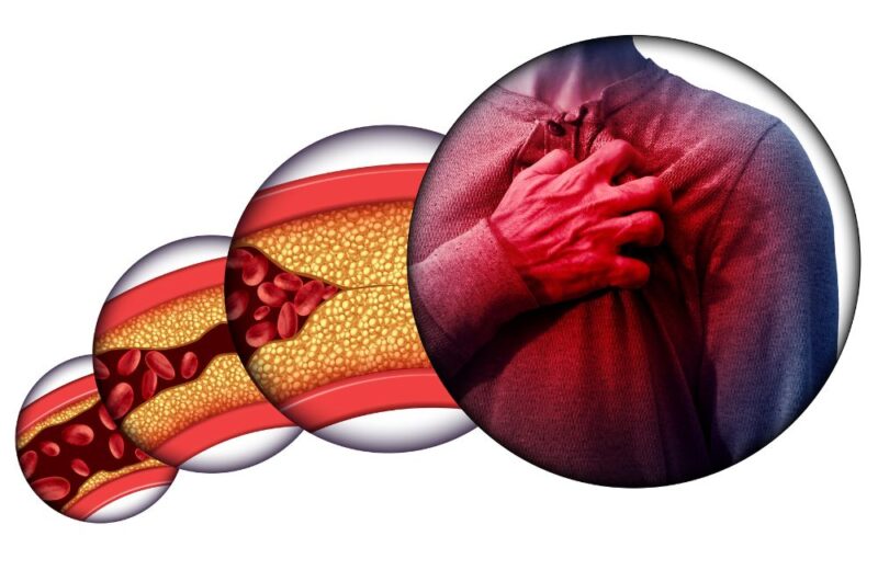 Cutting Out This Food Can Significantly Decrease Your Risk of Heart Disease