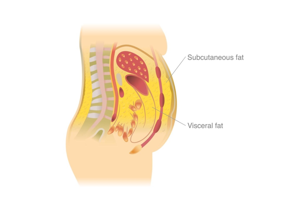 Belly fat - visceral fat