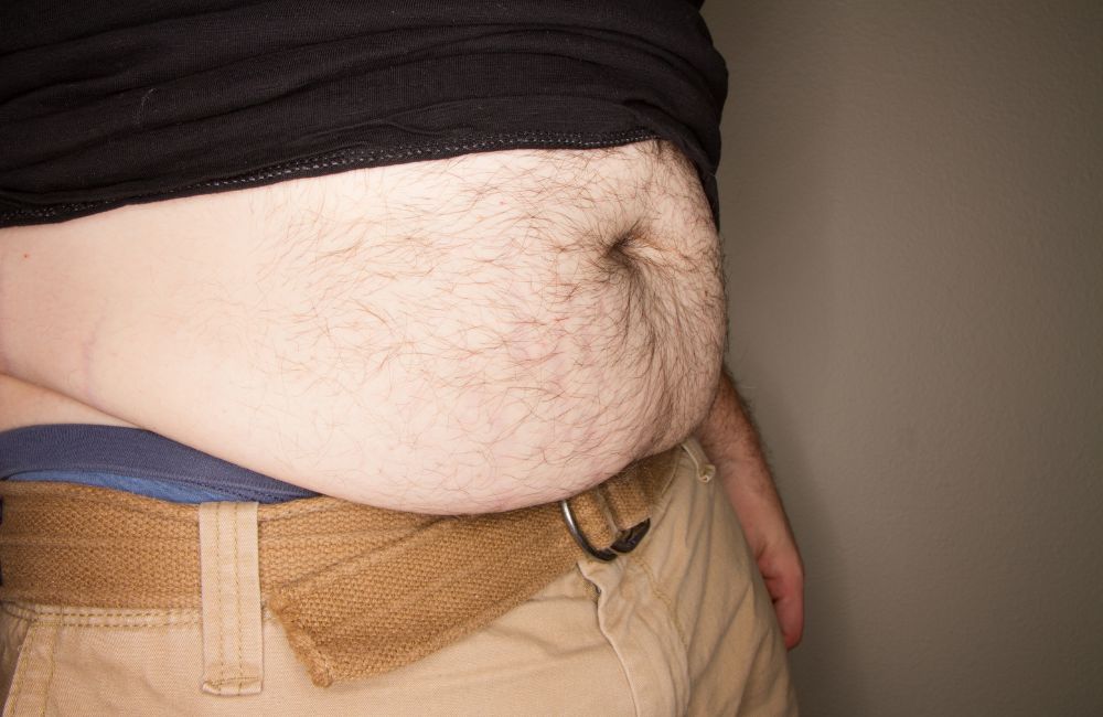 Apron Belly: How to Get Rid of the Stomach Sagging