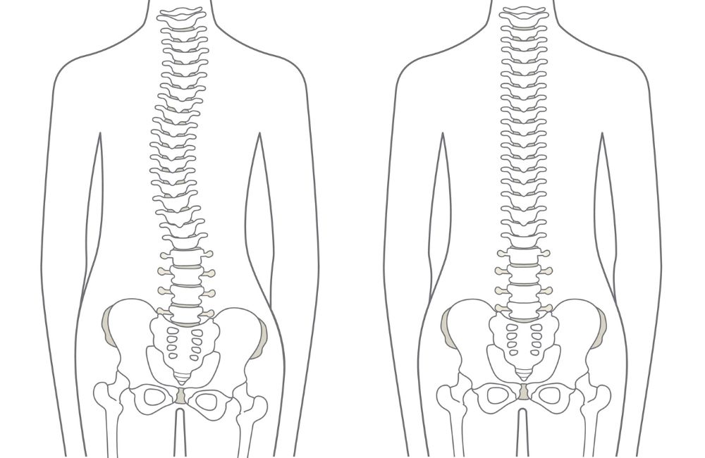 5 Great Exercises to Safeguard Your Spine